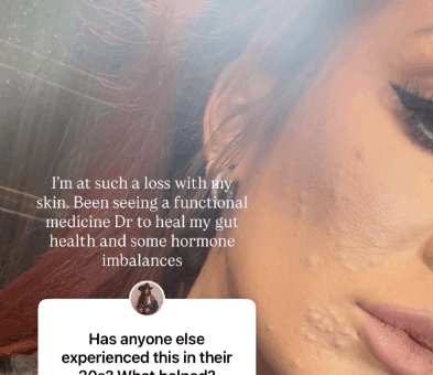 Chelsea’s Photo Stuns Fans