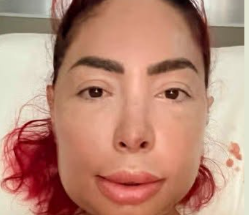 Farrah’s Surgery